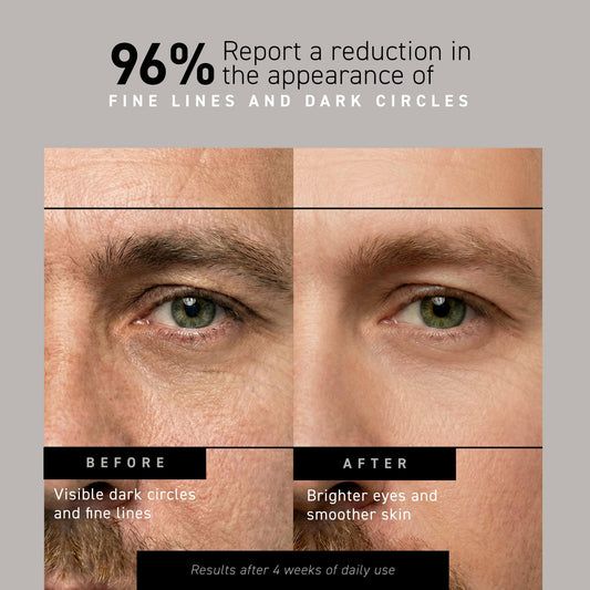 Brickell Men's Restoring Under Eye Cream for Men, Anti Aging Eye Balm To Reduce Puffiness, Wrinkles, Dark Circles, Crows Feet & Eye Bags, Caffeine, Hyaluronic Acid & Protein Peptides, 0.5oz, Unscented